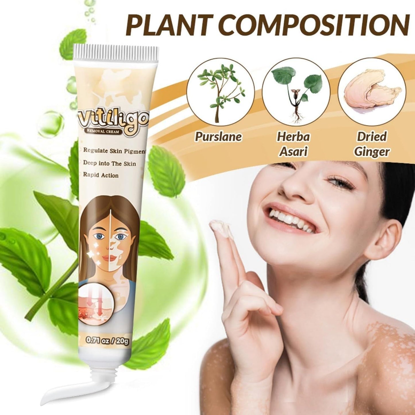 Vitiligo Removal Cream